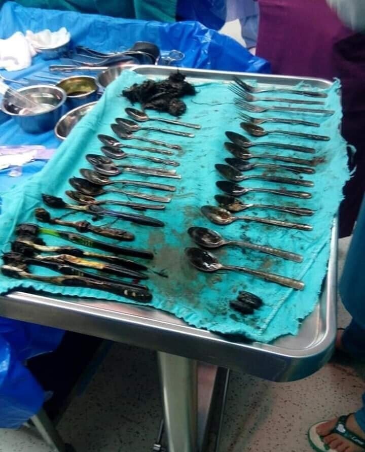 عملية جراحية