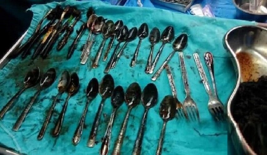 عملية جراحية