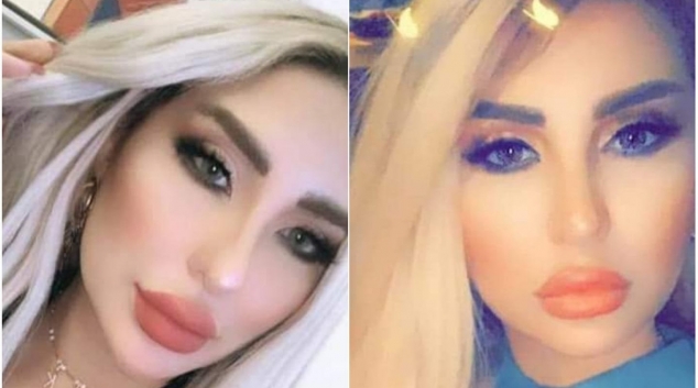 وفاة شابة تونسية أثناء عملية شفط الدهون