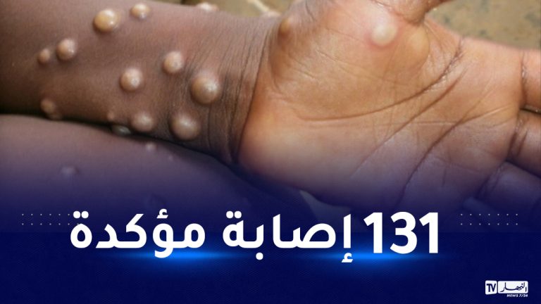 الصحة العالمية