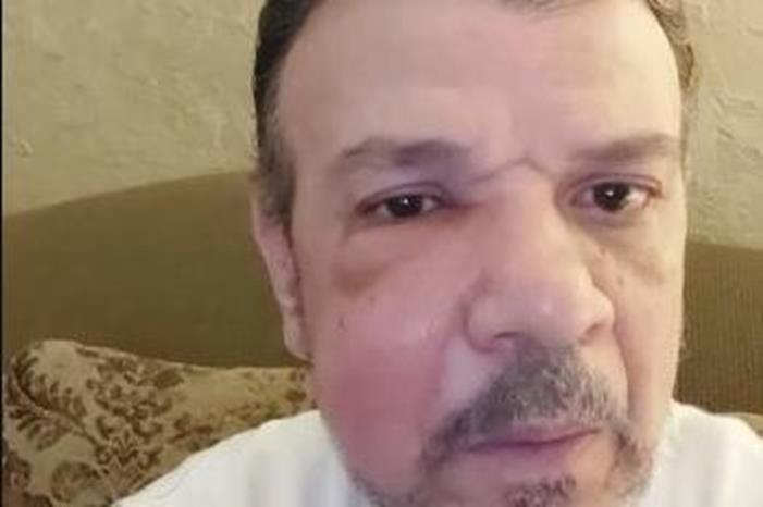 أحمد سلامة يكشف مفاجأة عن إصابته بورم خطير في الوجه – النهار أونلاين