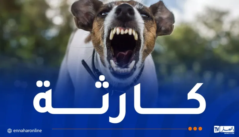 وفاة طفل بعضة كلب مُصاب بداء الكلب في باتنة