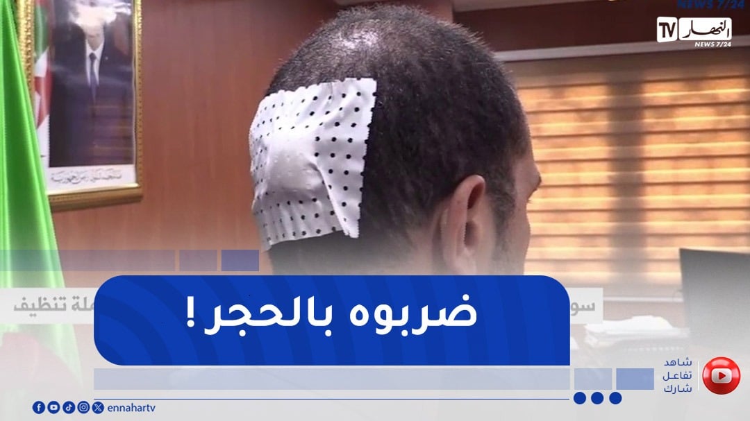 سوق أهراس : مجهولون يعتدون على رئيس بلدية ونائبه خلال حملة تنظيف
