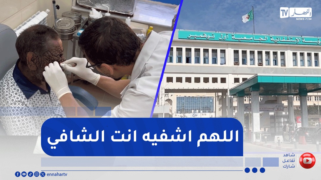 وهران.. مستشفى أول نوفمبر الجامعي يواصل متابعة حالة عبد الحفيظ