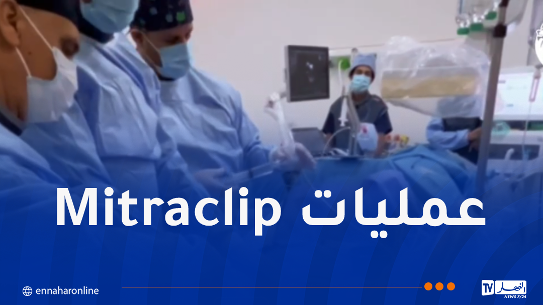 إنجاز طبي غير مسبوق في مستشفى وهران